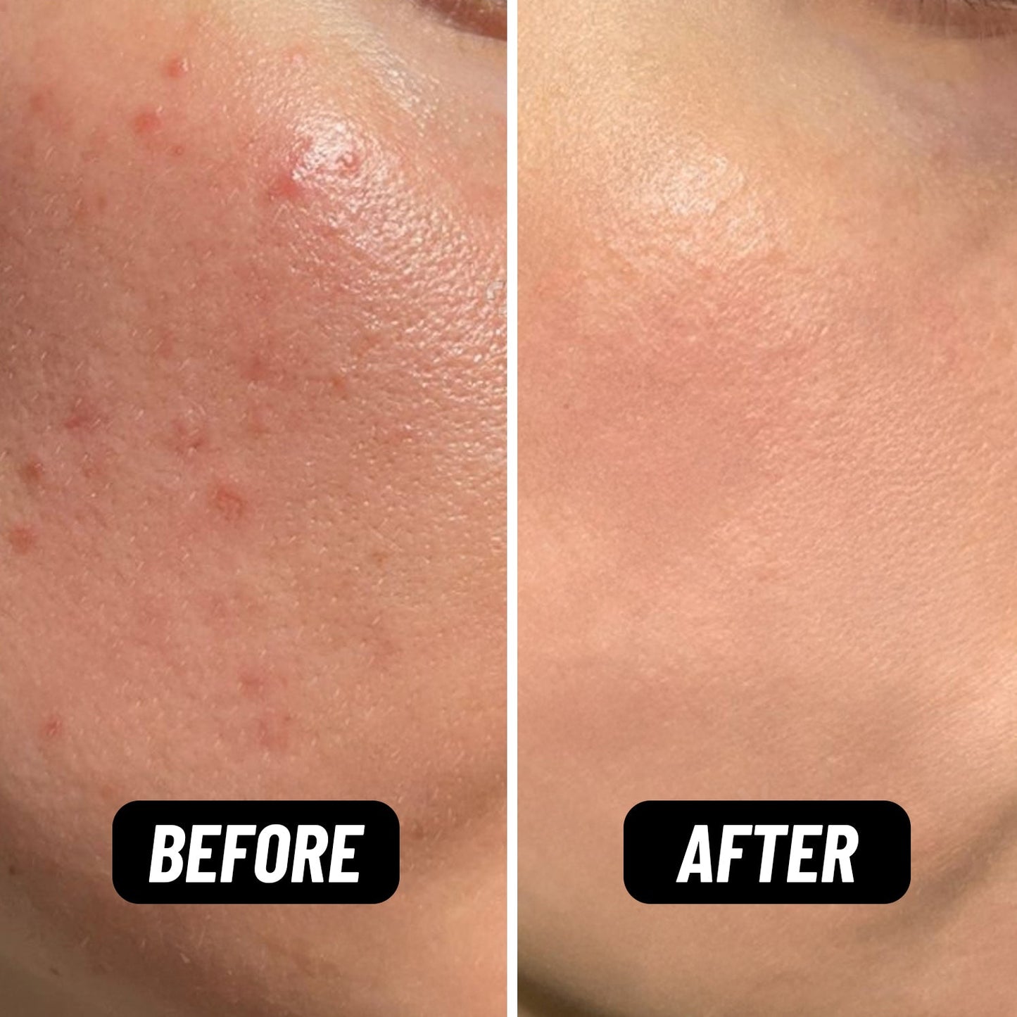 Bring Your Fire Facial Oil – Calm & Soothe Sensitive Skin 30ml
